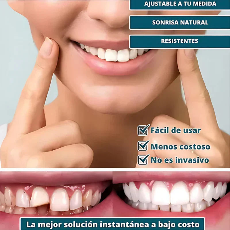 SmilePro 🦷 - Carillas Dentales Ajustables De Resina