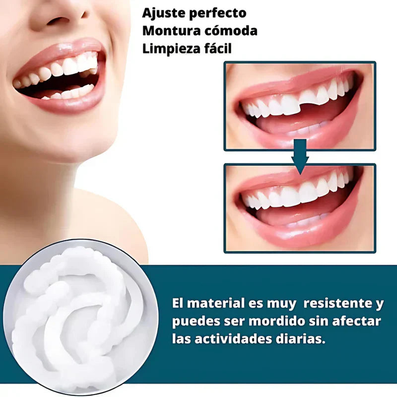 SmilePro 🦷 - Carillas Dentales Ajustables De Resina