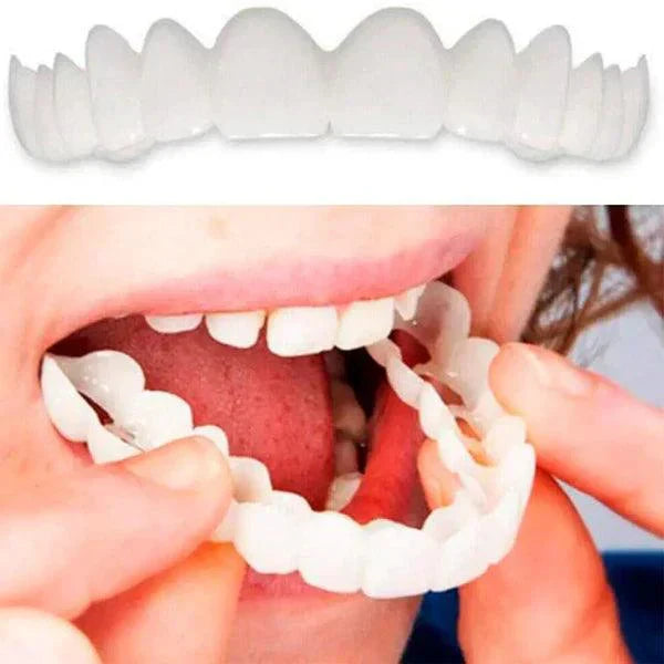 SmilePro 🦷 - Carillas Dentales Ajustables De Resina